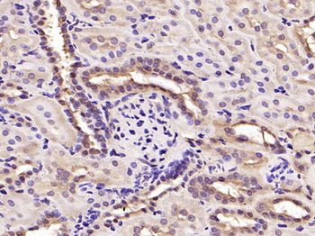 Cyclin D1 antibody