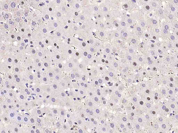 Cyclin D1 antibody