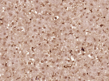 Cyclin D1 antibody