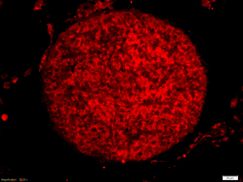 Cyclin E antibody