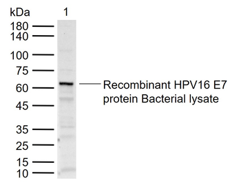 HPV16 E7 antibody