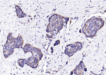 ECM1 antibody