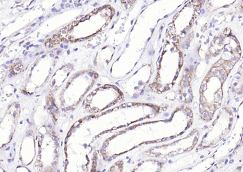 ECM1 antibody