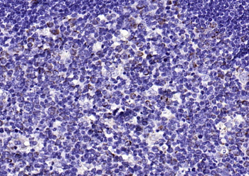 ECM1 antibody