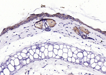 ECM1 antibody