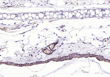 ECM1 antibody