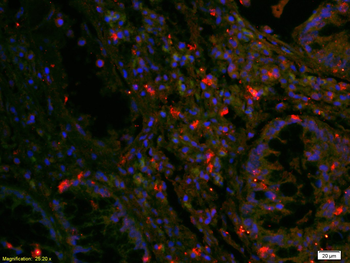 EGFR antibody