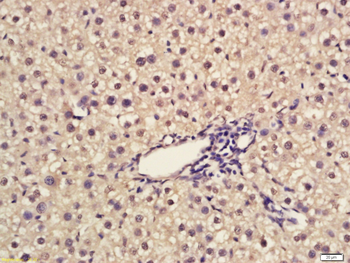 Egr1 antibody