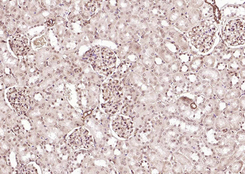 ERCC1 antibody