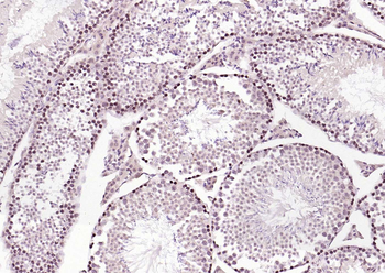 ERCC1 antibody