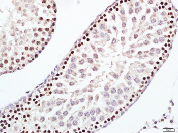 ERCC1 antibody