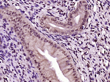 ERCC1 antibody