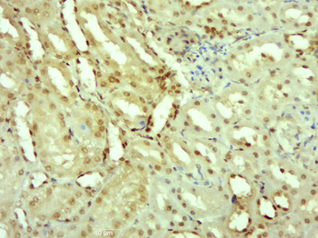 IRS1 (phospho-Ser307) antibody