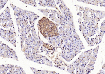 STAT3 (phospho-Tyr705) antibody