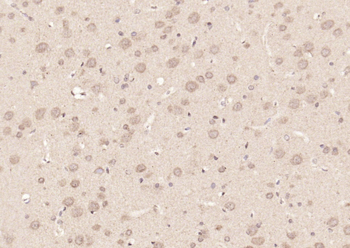 STAT3 (phospho-Tyr705) antibody