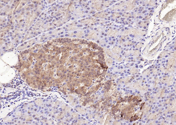 STAT3 (phospho-Tyr705) antibody