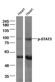 STAT3 (phospho-Tyr705) antibody