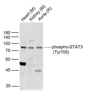 STAT3 (phospho-Tyr705) antibody