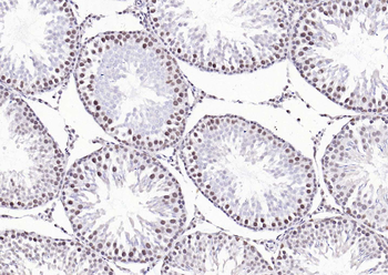 Estrogen Recepter beta antibody