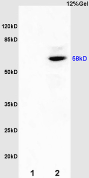 Estrogen Recepter beta antibody