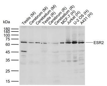 Estrogen Recepter beta antibody