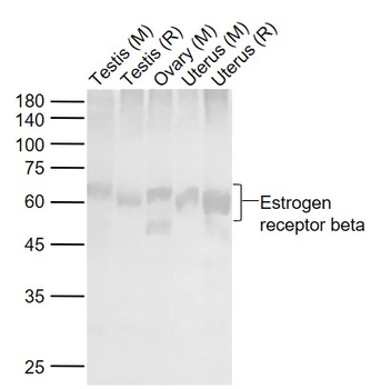 Estrogen Recepter beta antibody