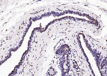 Estrogen Recepter beta antibody