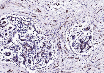 Estrogen Recepter beta antibody