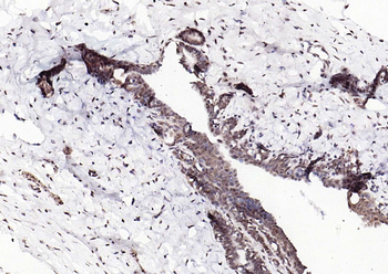 Estrogen Recepter beta antibody