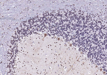 Estrogen Recepter beta antibody