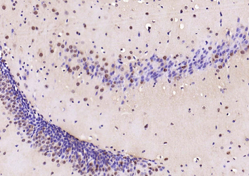 Smad3(phospho-Ser213) antibody