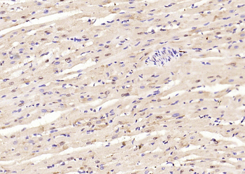 Smad3(phospho-Ser213) antibody