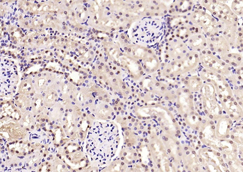 Smad3(phospho-Ser213) antibody