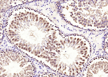 Smad3(phospho-Ser213) antibody