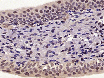 NFkB p65 (phospho-Ser276) antibody