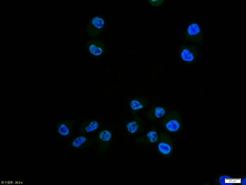 NFkB p65 (phospho-Ser276) antibody