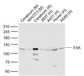 FAK antibody