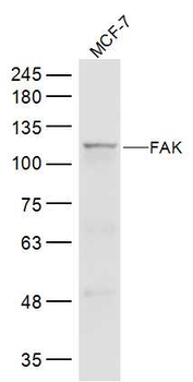 FAK antibody