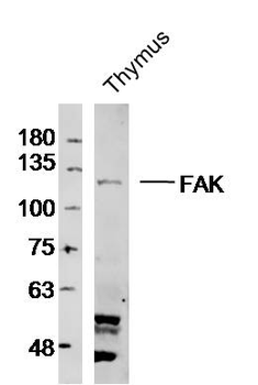 FAK antibody