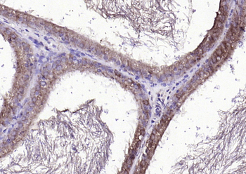 FGF8 antibody