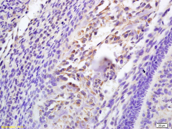 Galectin 3 antibody