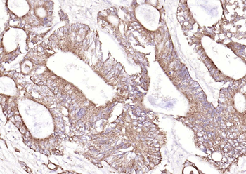 Galectin 3 antibody