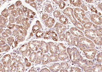 Galectin 3 antibody