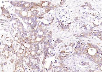 Galectin 3 antibody