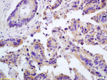 Galectin 3 antibody