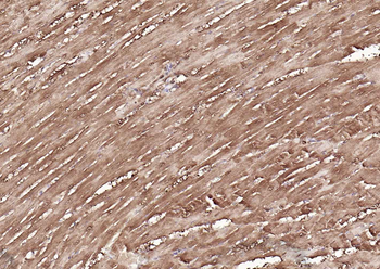 GAPDH monoclonal antibody