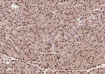 GAPDH monoclonal antibody