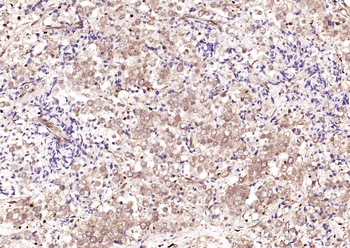 GAPDH monoclonal antibody