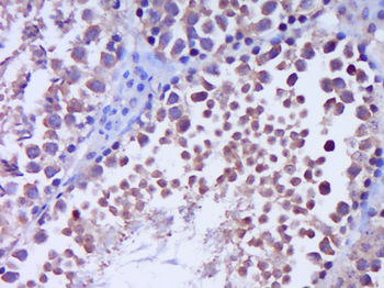 GLI1 antibody