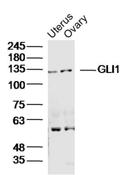 GLI1 antibody